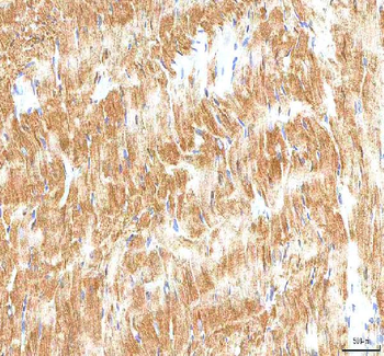 Hcn2 Rabbit Polyclonal Antibody