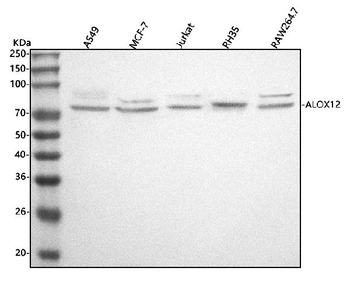 ALOX12 Rabbit Polyclonal Antibody