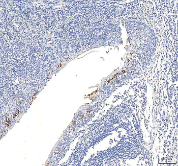 SGK493/PKDCC Rabbit Polyclonal Antibody