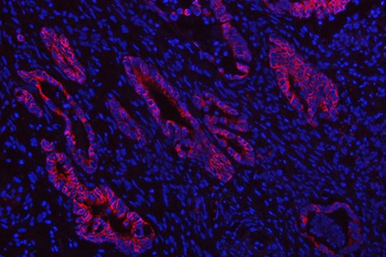 SGK493/PKDCC Rabbit Polyclonal Antibody
