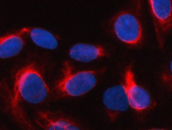 SGK493/PKDCC Rabbit Polyclonal Antibody