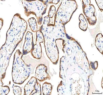 SGK493/PKDCC Rabbit Polyclonal Antibody