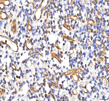 PHF6 Rabbit Polyclonal Antibody