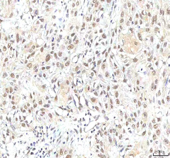 PHF6 Rabbit Polyclonal Antibody