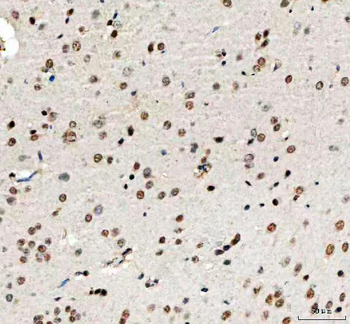 PHF6 Rabbit Polyclonal Antibody