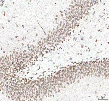 PHF6 Rabbit Polyclonal Antibody