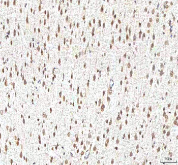 PHF6 Rabbit Polyclonal Antibody