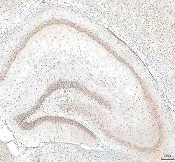 PHF6 Rabbit Polyclonal Antibody