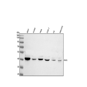 PHF6 Rabbit Polyclonal Antibody