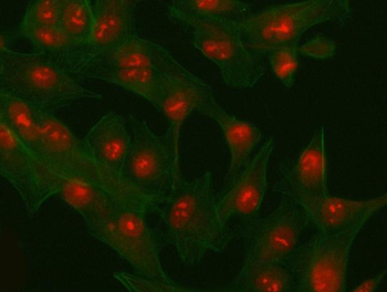 PHF6 Rabbit Polyclonal Antibody