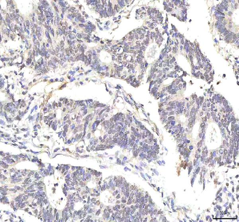 PHF6 Rabbit Polyclonal Antibody