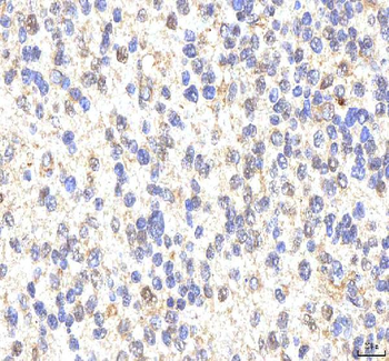 PHF6 Rabbit Polyclonal Antibody