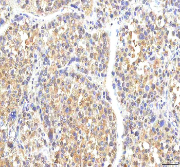 PHF6 Rabbit Polyclonal Antibody