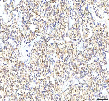 PHF6 Rabbit Polyclonal Antibody