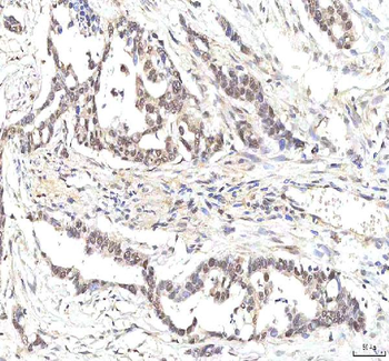 PHF6 Rabbit Polyclonal Antibody