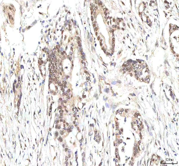 PHF6 Rabbit Polyclonal Antibody