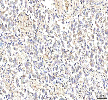 PHF6 Rabbit Polyclonal Antibody
