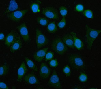 EIF3B Rabbit Polyclonal Antibody