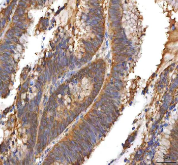 EIF3B Rabbit Polyclonal Antibody