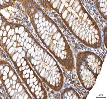 EIF3B Rabbit Polyclonal Antibody