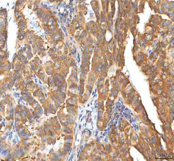 EIF3B Rabbit Polyclonal Antibody