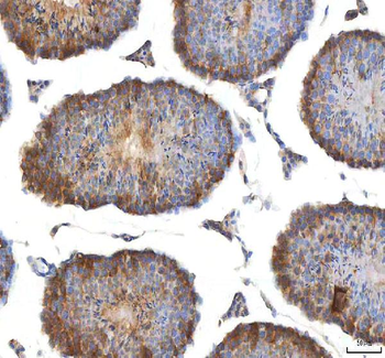 EIF3B Rabbit Polyclonal Antibody