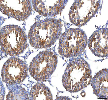 EIF3B Rabbit Polyclonal Antibody