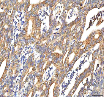 PDF Rabbit Polyclonal Antibody