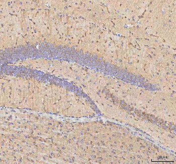 BPNT2 Rabbit Polyclonal Antibody