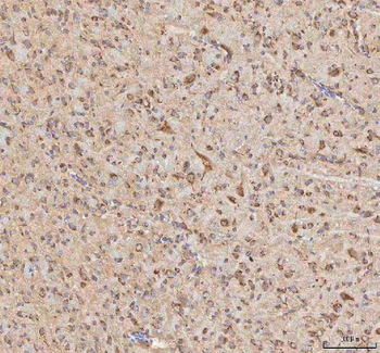 BPNT2 Rabbit Polyclonal Antibody