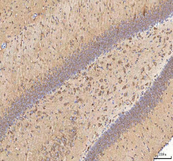 BPNT2 Rabbit Polyclonal Antibody