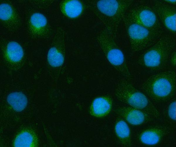 BPNT2 Rabbit Polyclonal Antibody