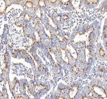 BPNT2 Rabbit Polyclonal Antibody