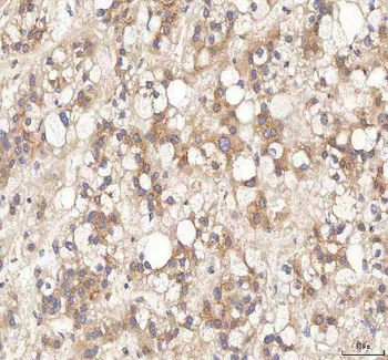 BPNT2 Rabbit Polyclonal Antibody