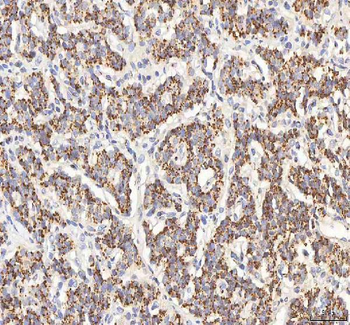 BPNT2 Rabbit Polyclonal Antibody