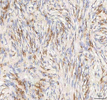 BPNT2 Rabbit Polyclonal Antibody