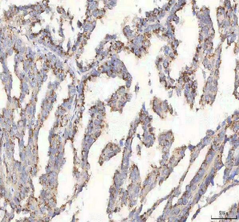 BPNT2 Rabbit Polyclonal Antibody