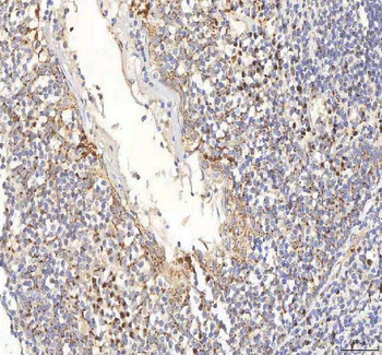 BPNT2 Rabbit Polyclonal Antibody