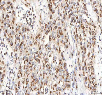 BPNT2 Rabbit Polyclonal Antibody