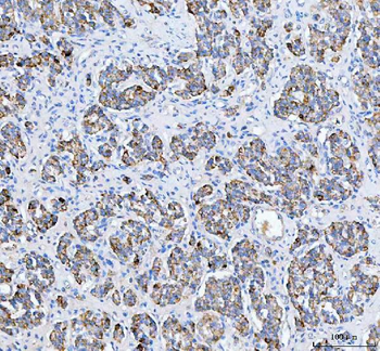 PELI3 Rabbit Polyclonal Antibody