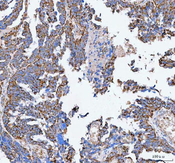 PELI3 Rabbit Polyclonal Antibody