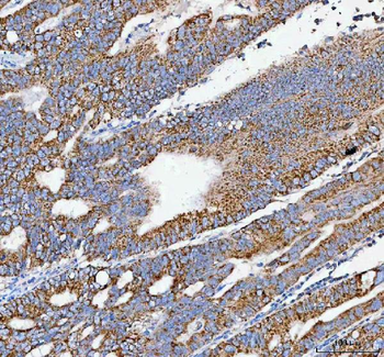 PELI3 Rabbit Polyclonal Antibody