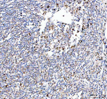 PELI3 Rabbit Polyclonal Antibody