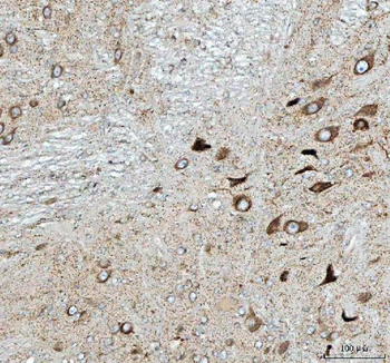 PELI3 Rabbit Polyclonal Antibody