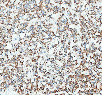 RAB3IP Rabbit Polyclonal Antibody