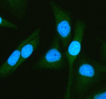 ATG7 Rabbit Polyclonal Antibody