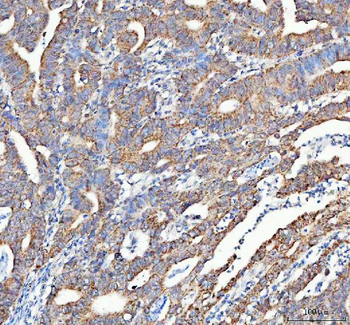 ATG7 Rabbit Polyclonal Antibody