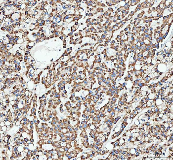 ATG7 Rabbit Polyclonal Antibody