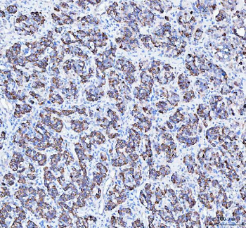 ATG7 Rabbit Polyclonal Antibody