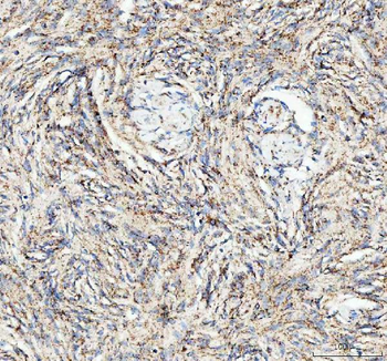 ATG7 Rabbit Polyclonal Antibody